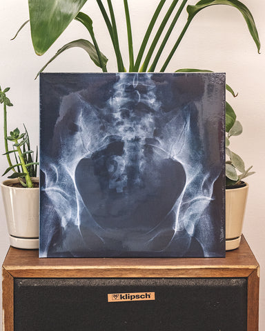 VA – Antipodean Anomalies 2 • 2×LP (2022)